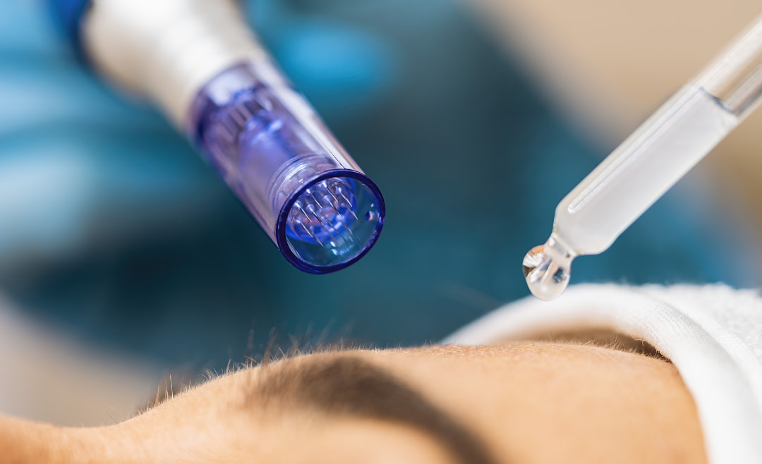 Dra. Iasmin Ledo - Bioestimuladores Salvador BA